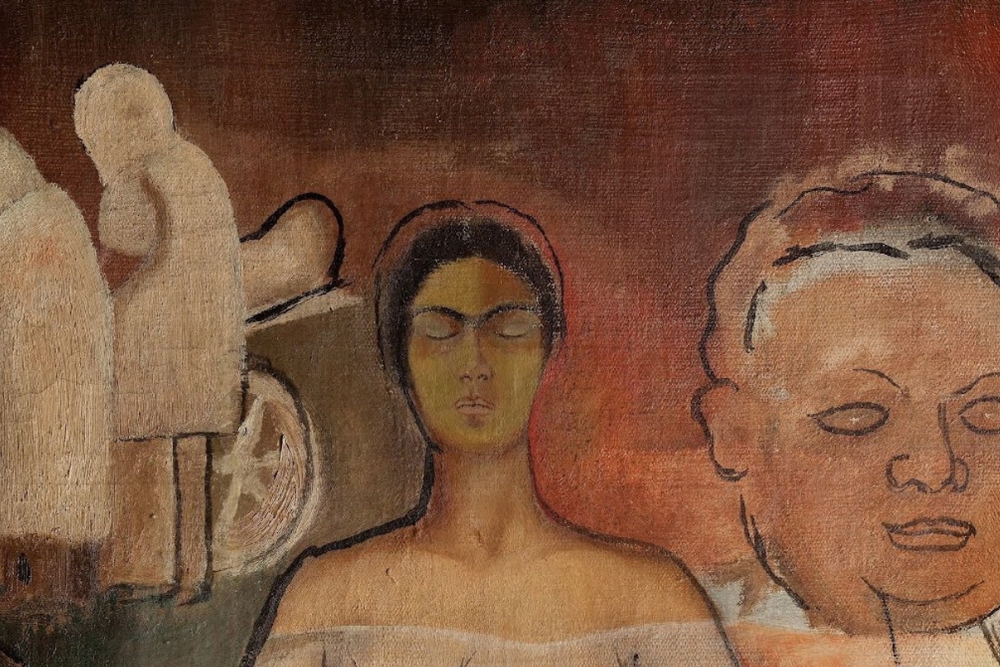Frida and the Cesarean La Casa Azul